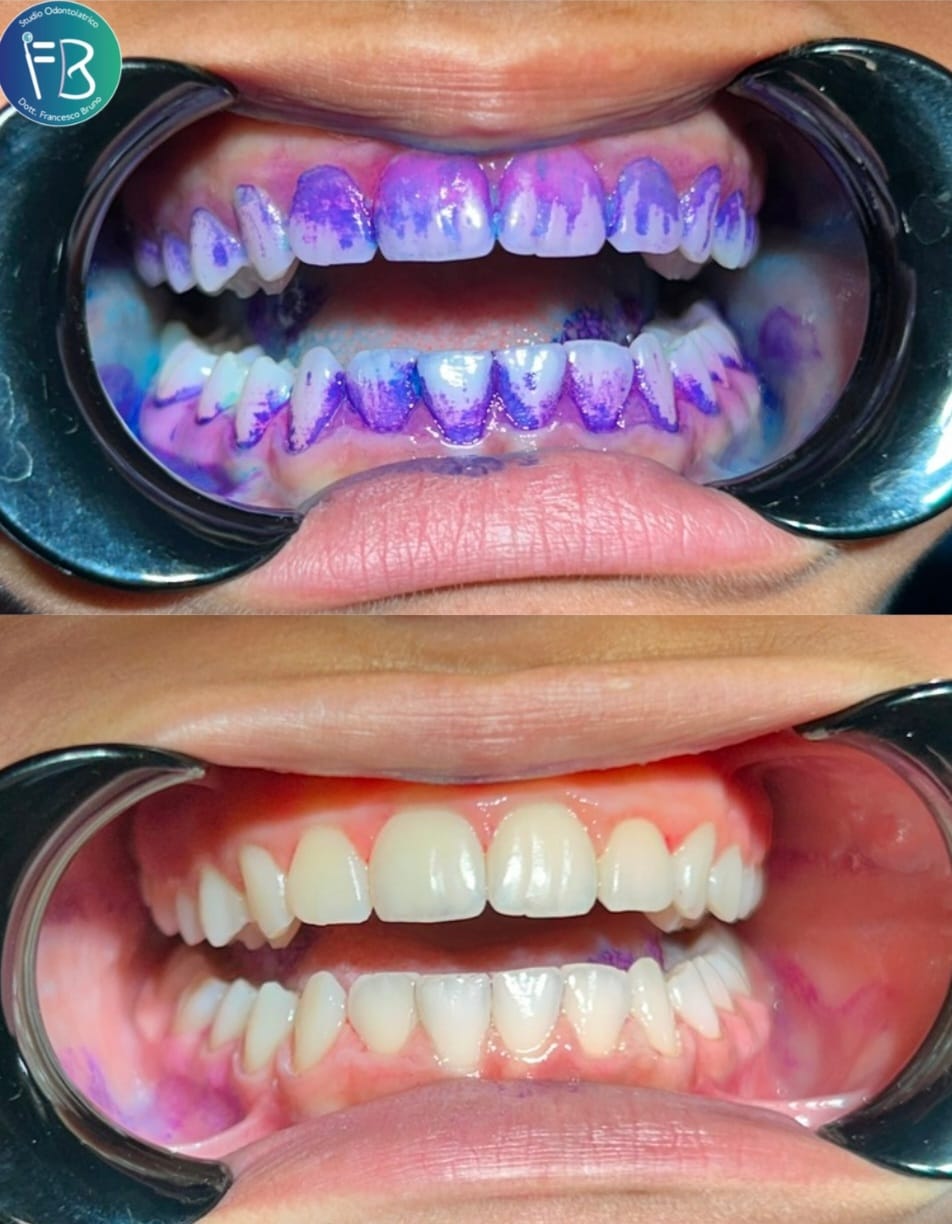 IGIENE DENTALE🦷:LA GUIDA COMPLETA PER UN SORRISO SANO!